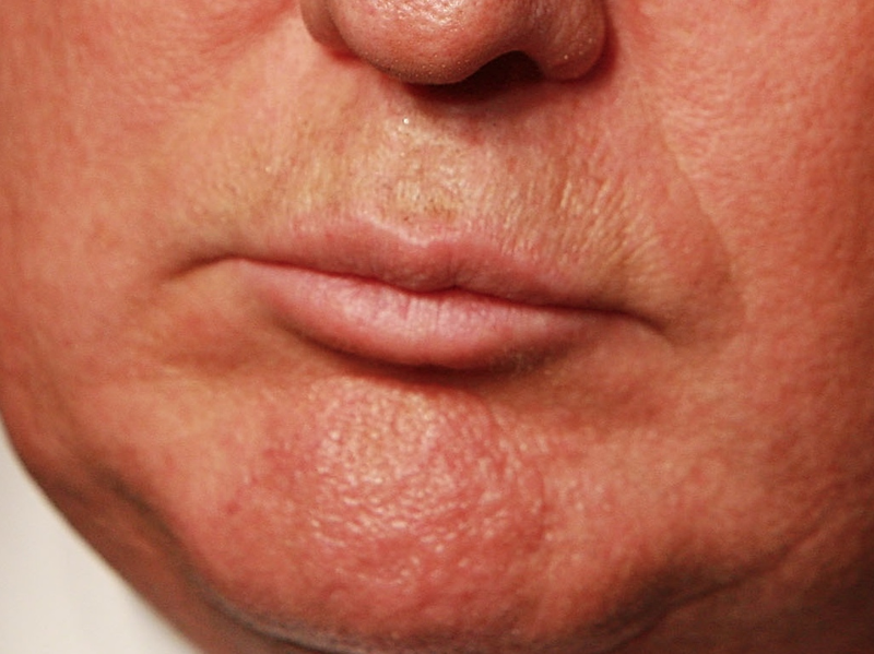 Illustration for article titled A Visual History of Donald Trump's Mouth